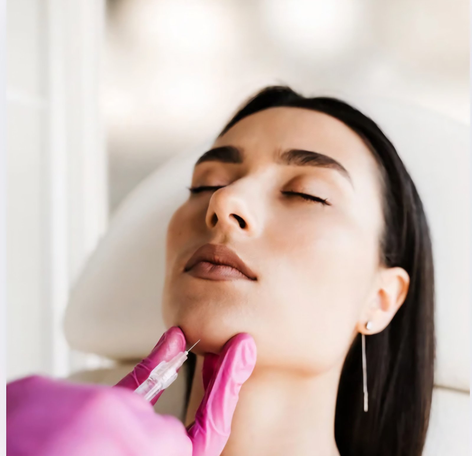 Ácido hialurónico en mentón Doctora Claudia Zabala Ácido hialurónico en mentón Doctora Claudia Zabala