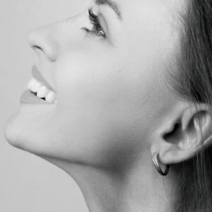 Ácido hialurónico en reborde mandibular